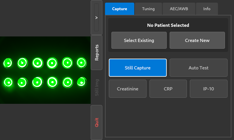 The SepsisDx capture screen: the illuminated assay wells on the left, and controls for selecting a patient and running a creatinine, CRP, or IP-10 test on the right