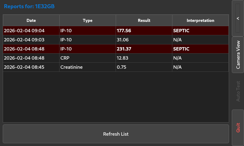 The SepsisDx report screen: a table of dated test results by type and value, with two IP-10 rows flagged SEPTIC